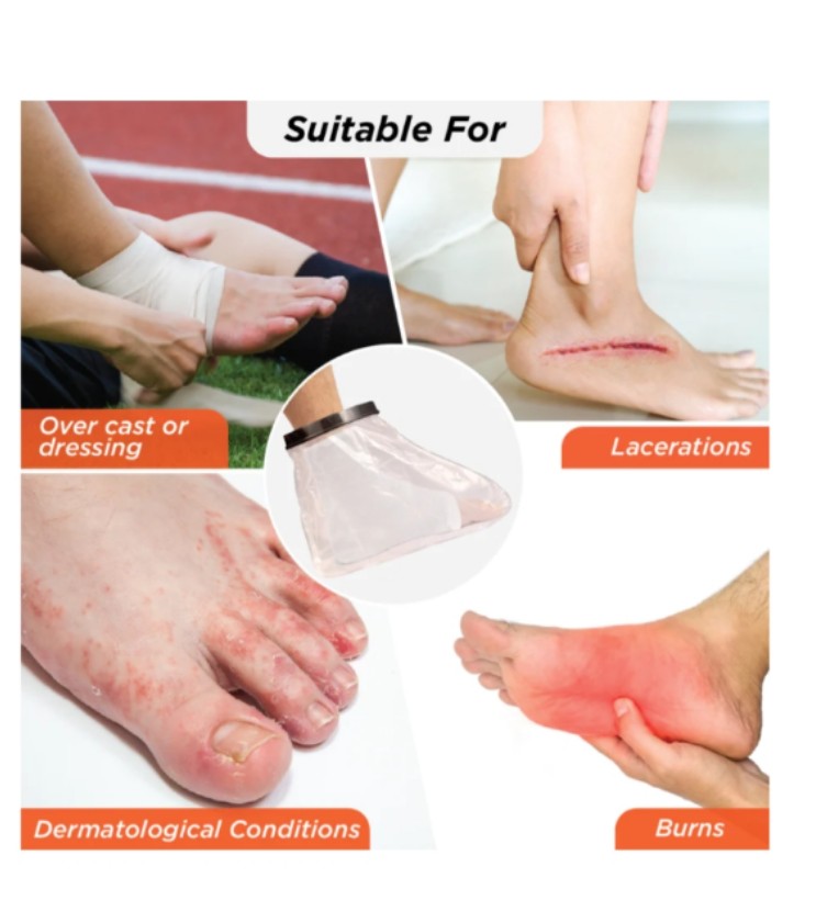 VISSCO CAST COVER - LEG