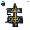 Neil Robertson Rollable Stretcher Arrex STR 100