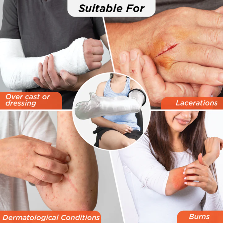 VISSCO Cast Cover Arm (From Wrist to Upper Arm) - P.C.No. 0827