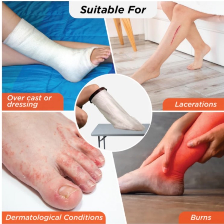 VISSCO CAST COVER - LEG