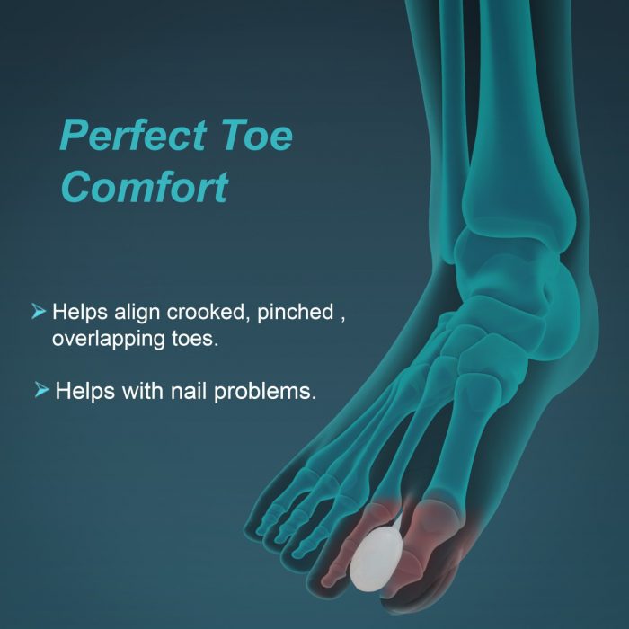 Silicone Toe Separators for Alignment & Bunion Relief TYNOR K-04